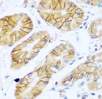 NCAM1 Rabbit Polyclonal Antibody