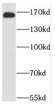 NCAPD3 Antibody