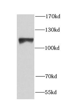 NCL Rabbit Polyclonal Antibody