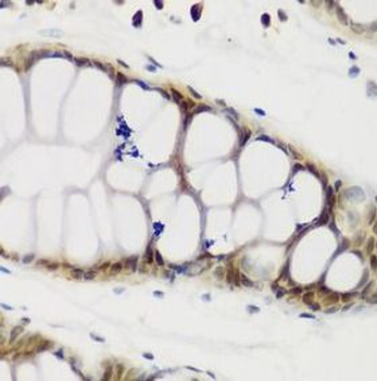 NCL Rabbit Polyclonal Antibody