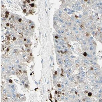NCLN Antibody