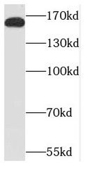 NCOA3 Antibody