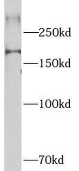 NCOR2 Rabbit Polyclonal Antibody