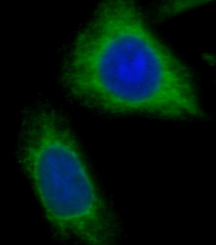 NDUFB8 Rabbit Polyclonal Antibody