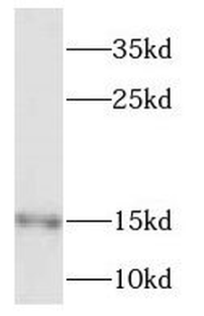 NDUFS5 Rabbit Polyclonal Antibody
