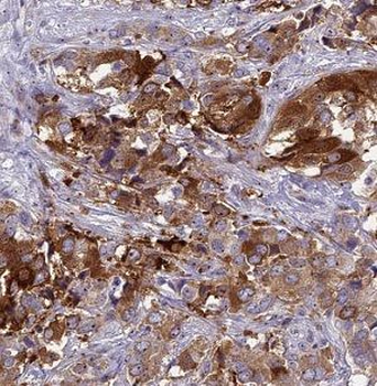 NDUFS6 Rabbit Polyclonal Antibody