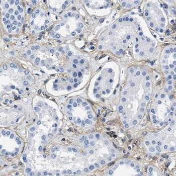 NDUFV3 Rabbit Polyclonal Antibody