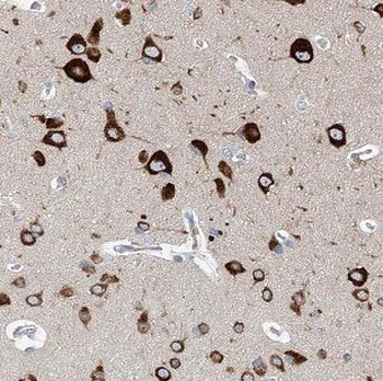 NECAB2 Antibody
