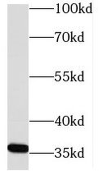 NECAP2 Antibody