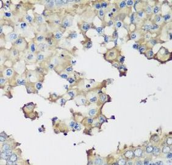 NEDD4L Rabbit Polyclonal Antibody