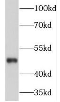 NEK2 Rabbit Polyclonal Antibody