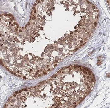 NEK2 Rabbit Polyclonal Antibody