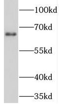 NET1 Rabbit Polyclonal Antibody