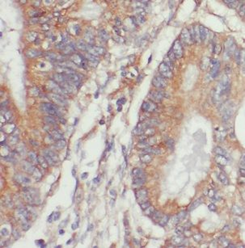 NET1 Rabbit Polyclonal Antibody
