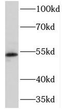 NEU4 Rabbit Polyclonal Antibody