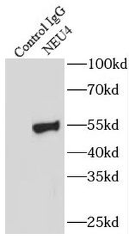 NEU4 Rabbit Polyclonal Antibody