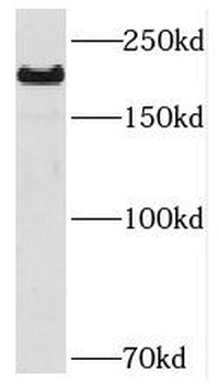 NAV1 Antibody