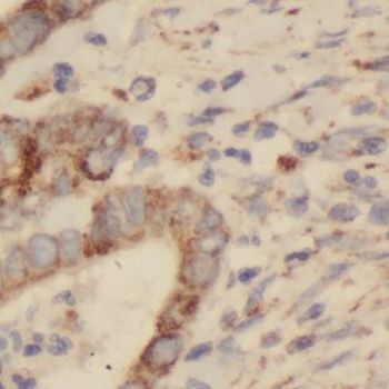 NFE2 Rabbit Polyclonal Antibody