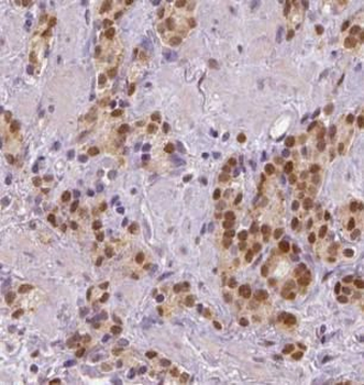 NFIA Rabbit Polyclonal Antibody