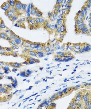 NFKB1 Rabbit Polyclonal Antibody