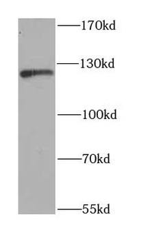 NFKB1 Rabbit Polyclonal Antibody
