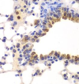 NFKB1 Rabbit Polyclonal Antibody