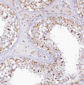 NGDN Rabbit Polyclonal Antibody
