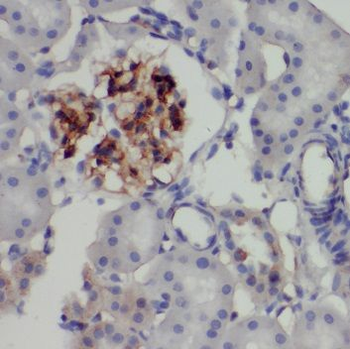 NID2 Rabbit Polyclonal Antibody