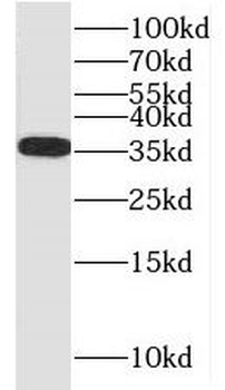 NIT1 Rabbit Polyclonal Antibody