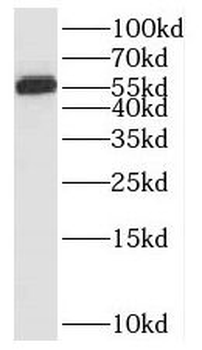 CDKL3 Rabbit Polyclonal Antibody