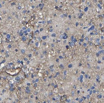 CDKL3 Rabbit Polyclonal Antibody