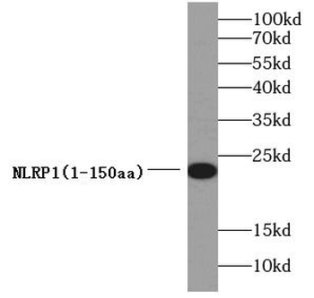NLRP1 Antibody