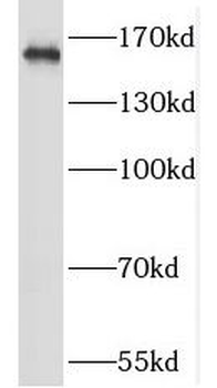 GRIN2A Antibody