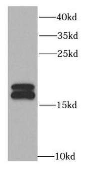 NME1 Rabbit Polyclonal Antibody