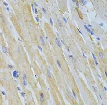 NME1 Rabbit Polyclonal Antibody