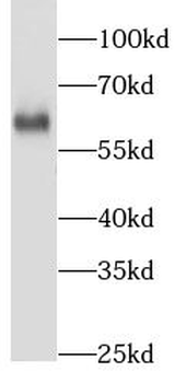 NOP58 Rabbit Polyclonal Antibody