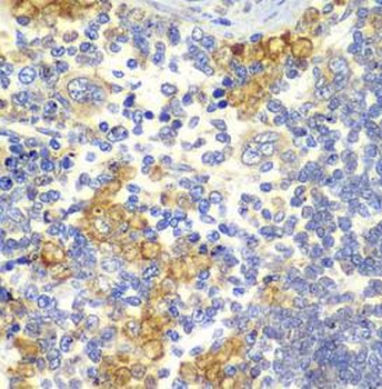 NOTCH1 Rabbit Polyclonal Antibody