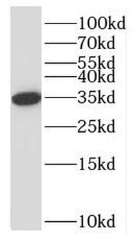 NPL Antibody
