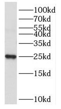 NPM3 Antibody