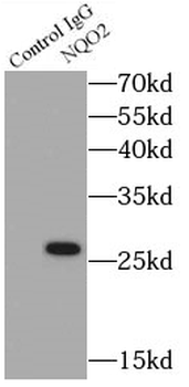 NQO2 Rabbit Polyclonal Antibody