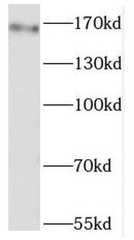 GRIN2B Antibody