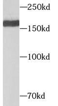 GRIN2B Antibody