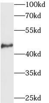 NR2E3 Antibody