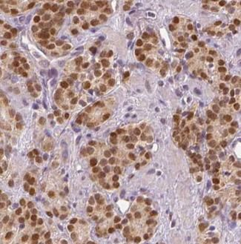 NR2E3 Rabbit Polyclonal Antibody