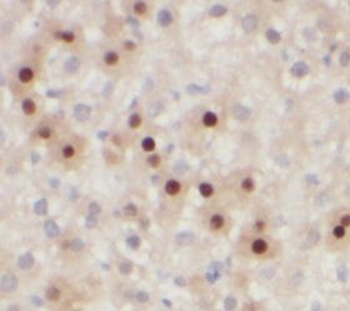 NR5A1 Rabbit Polyclonal Antibody