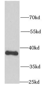 NRBF2 Rabbit Polyclonal Antibody