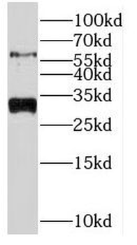 NRBP2 Antibody