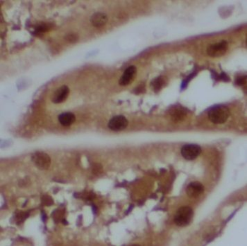 NRIP3 Rabbit Polyclonal Antibody