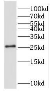 NRSN2 Rabbit Polyclonal Antibody