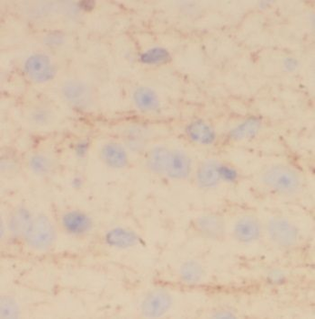 NRSN2 Rabbit Polyclonal Antibody
